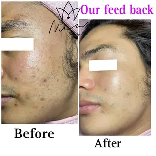 Mia beauty所属・MiA Beautyのエステ・リラクイメージ