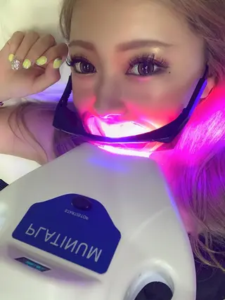 ホワイトニング ⚓︎CREW柏⚓︎のその他イメージ