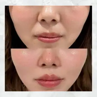 マツエク・マツパ 愛維美水光美肌専門店所属・愛維美水光美肌専門店 メンズレディースokのエステ・リラクイメージ