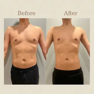 お腹痩せエステ Flat BELLY 恵比寿所属・【腸もみ/脂肪冷却】 お腹エステ/恵比寿のエステ・リラクイメージ
