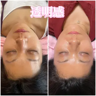 毛穴レス ハーブ& ワックス脱毛×光脱毛のエステ・リラクイメージ