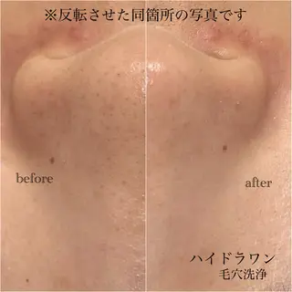 マツエク・マツパ omii salon 草津店:yurinaの眉毛・アイブロウイメージ