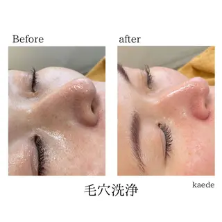 🎀kaede🎀 骨格似合わせ眉毛の眉毛・アイブロウイメージ