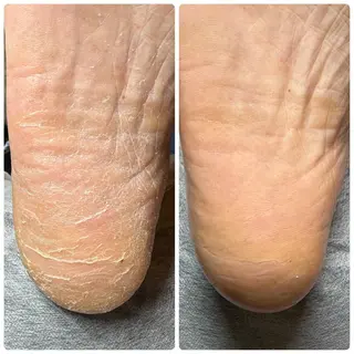 ネイル ROUN'　南 鈴沙のネイルデザイン