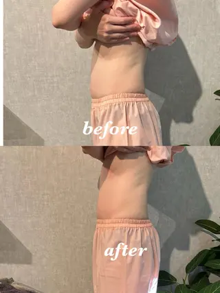 メンズ 腸活サポート みなみののエステ・リラクイメージ