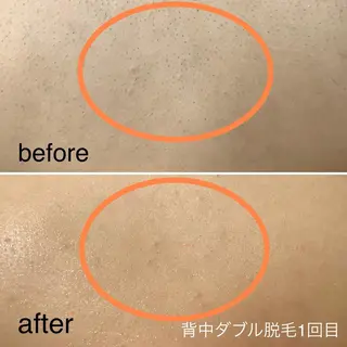 脱毛&エステサロン JIGGLY☆松田のエステ・リラクイメージ