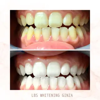 メンズ LBSホワイトニング 銀座店💎店長浦和のその他イメージ