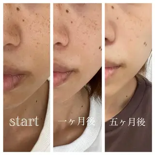 武藤 千裕のエステ・リラクイメージ