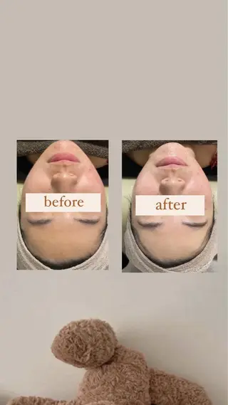 crescent所属・【韓国肌管理・脱毛】 クレセントのエステ・リラクイメージ