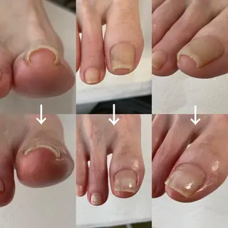 ネイル Takasaki Keikoのネイルデザイン