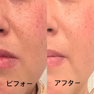 おうちサロン B-ROOMのエステ・リラクイメージ