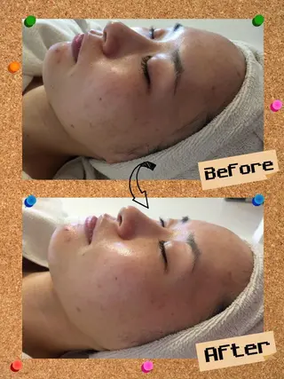 大名 Kalon（カロン）のエステ・リラクイメージ