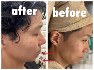 XXXY'S　COLOR FEEL　facial & nail所属・サイズカラーフィール おまみのエステ・リラクイメージ