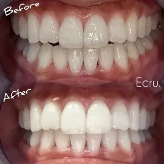 メンズ キッズ ホワイトニングサロン Ecru所属・ホワイトニングサロン Ecru エクリュのその他イメージ