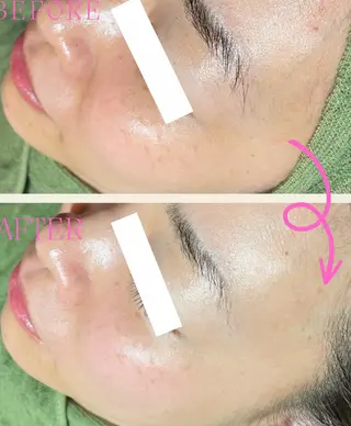 痩身・フェイシャル/if byOrabriller所属・if byOrab riller【イフ】のその他イメージ