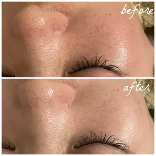 メンズ メナード岐阜茜部 杉浦のエステ・リラクイメージ