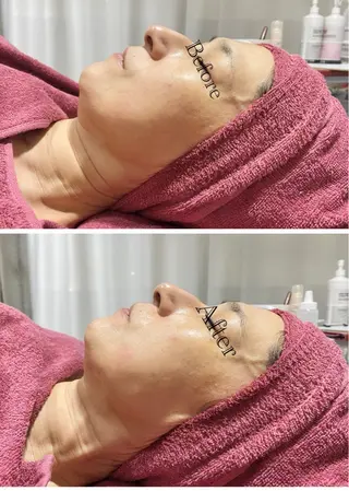 Chalon所属・REVI取扱・肌悩み 毛穴Chalonのエステ・リラクイメージ