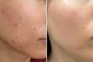 Lumiere despoir所属・Lumiere despoirのエステ・リラクイメージ