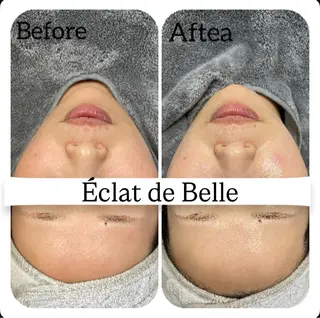 Éclat de Belle🫧白玉肌のエステ・リラクイメージ