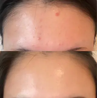 MiEL  total beaty salon所属・肌質改善サロン ナツコのエステ・リラクイメージ