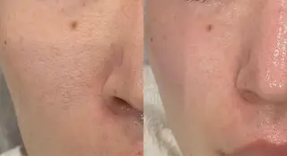 DeI'm   名古屋栄所属・小林 玲菜のエステ・リラクイメージ