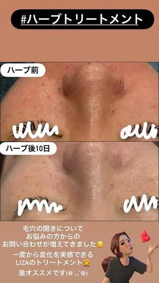 LiZA エステティックサロンのエステ・リラクイメージ