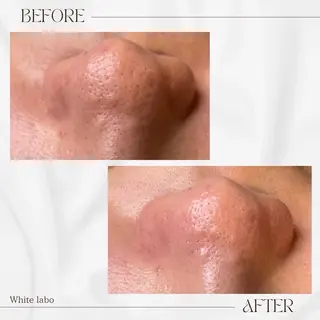 White labo 🇰🇷REIの眉毛・アイブロウイメージ