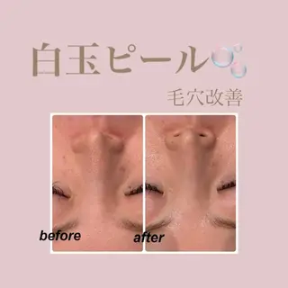 🌈Linora byRAYVIS🌈のエステ・リラクイメージ