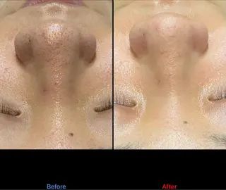 Einami 美肌痩身サロンのエステ・リラクイメージ