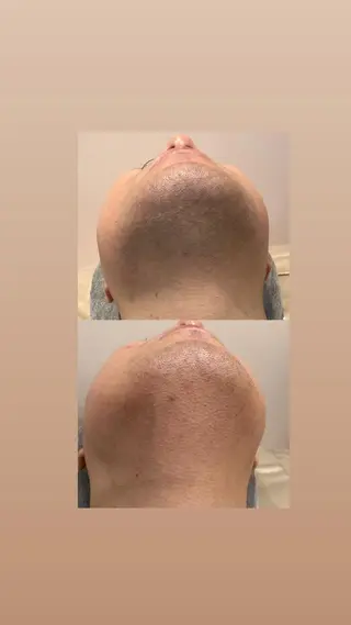 セミロング カラー パーマ ヘアアレンジ メンズ キッズ ネイル マツエク・マツパ アイブロウ Amaryllis 🌹松本のエステ・リラクイメージ