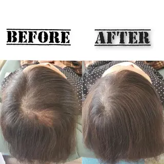 歯科提携セルフダック 宇都宮駒生店のエステ・リラクイメージ