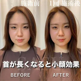 ロング カラー パーマ ヘアアレンジ メンズ キッズ ネイル マツエク・マツパ アイブロウ 即小顔♥️美容鍼× ハーブピーリングのその他イメージ