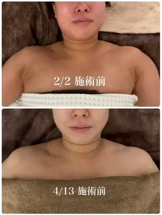 メンズ 小顔フェイシャル 専門店Soarのエステ・リラクイメージ