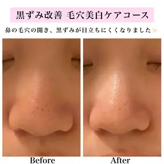 Bellesthe (ベルエステ)のエステ・リラクイメージ