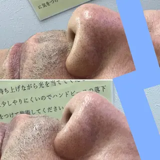 メンズ SHINY エステサロンのその他イメージ