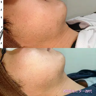 メンズ 武 藤のエステ・リラクイメージ