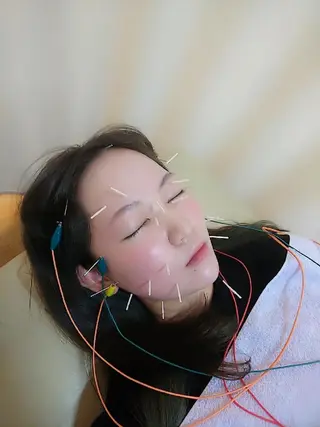 お顔のむくみたるみ 専門☆美容鍼小顔矯正のエステ・リラクイメージ