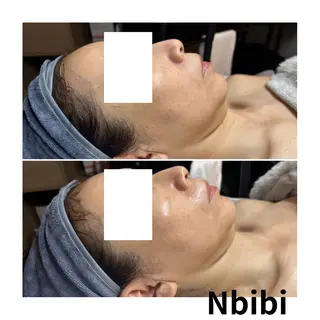 韓国🇰🇷価格 サロン_Nbibiのエステ・リラクイメージ