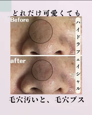 肌質改善サロン facialmoonのエステ・リラクイメージ