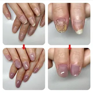 ネイル ネイルサロンアリューム所属・ネイルサロン アリュームのネイルデザイン