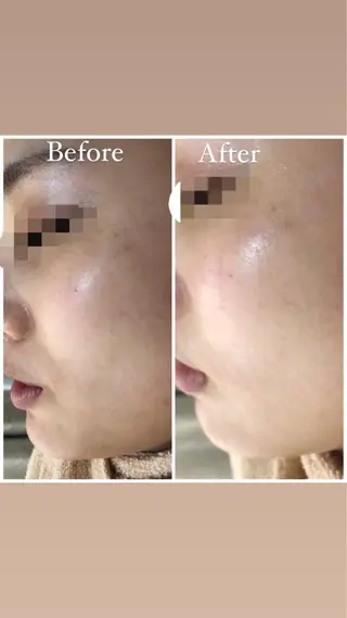 ロング カラー パーマ ヘアアレンジ メンズ キッズ ネイル マツエク・マツパ Amaryllis 🌹のエステ・リラクイメージ