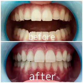 プライベートサロン Lｏｋａｈｉ飯生透のエステ・リラクイメージ