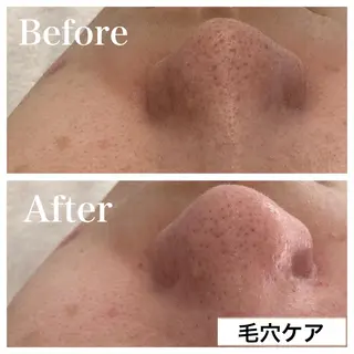 アイブロウ B&H所属・頭痛•肩こり専門/ 眉サロンB&H心斎橋のエステ・リラクイメージ