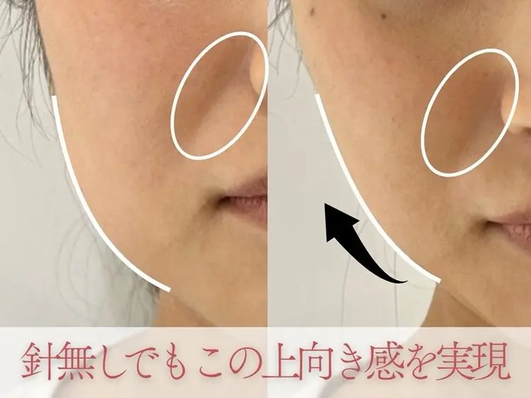 MORE BEAUTY ESTHE 本通り店の内観・外観2