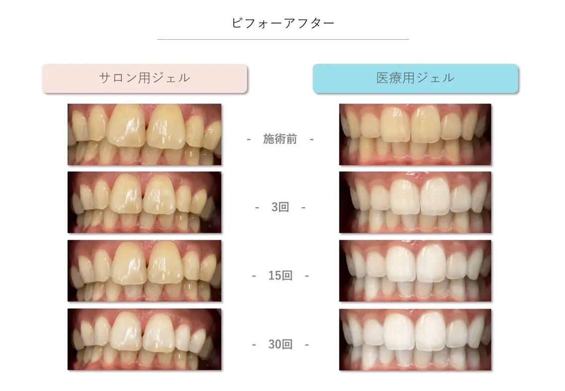 セルフホワイトニングサロン　Beteeの内観・外観3