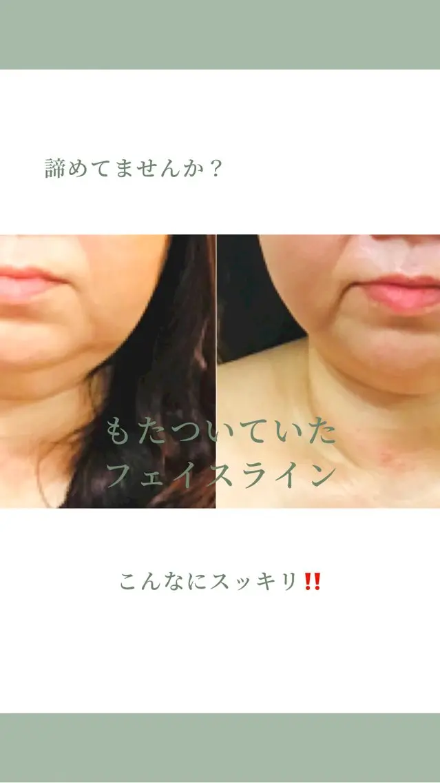 【小顔だけじゃない上半身がスッキリ！】小顔美肌トリートメントの写真