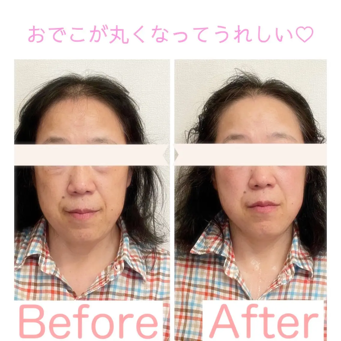 町田・鶴川 小顔矯正 /鈴木友実のエステ・リラクイメージ