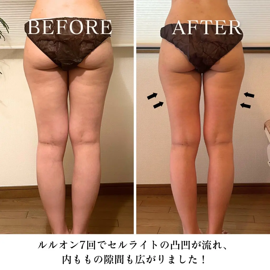 エステ リラク 【目黒】本格痩身✴︎ 最新型よもぎ蒸しのエステ・リラクイメージ