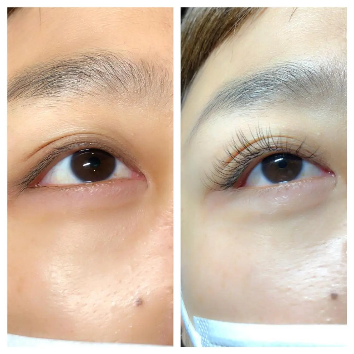 初回限定！フラットラッシュ100本✨前処理付きの写真