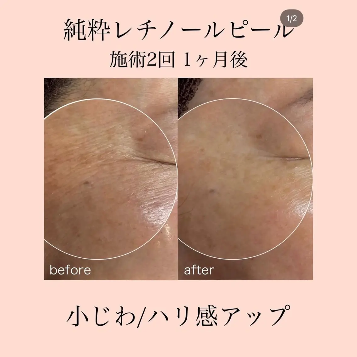 エステ 肌質改善×癒しサロン Ryanのエステ・リラクイメージ